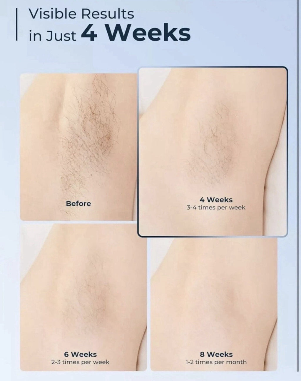 Laser Hair Removal for Women & Men IPL Ice-Cooling System