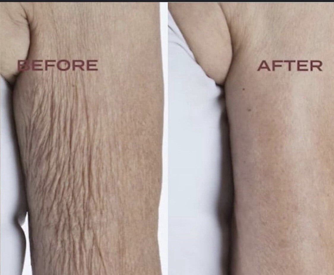 Body Firm Crêpe Erase Body Smoothing Pre-Treatment 265ml